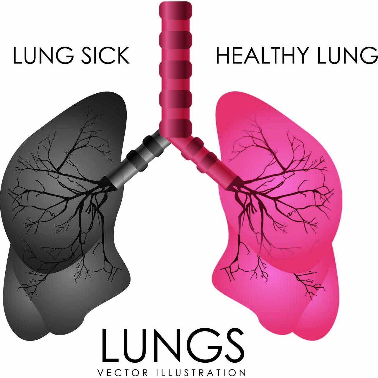 肺癌肺损伤世界哮喘日禁烟日肺健康禁烟矢量图
